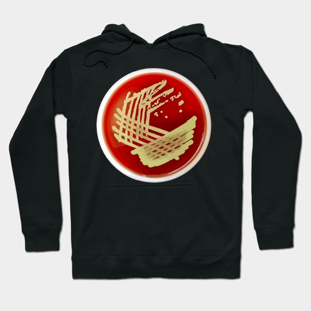 Bacterial Culture Streaks E.coli Petri Dish in Microbiology Lab Gold Red Yellow Hoodie by labstud